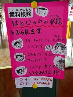 歯科検診って何？