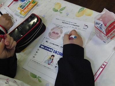 やっぱりあった！みがき残し…