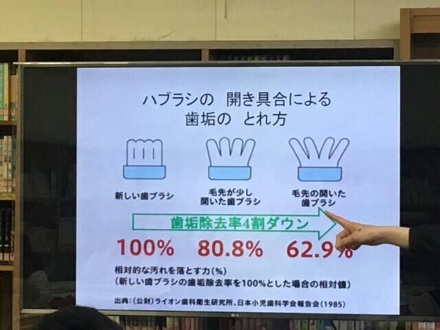 歯と口の健康指導